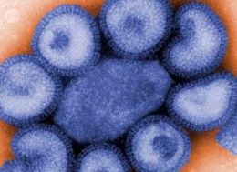 Swine Flu Suspected in Middlefield, Possibly Elsewhere