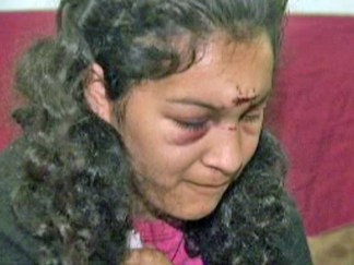 Mother Tells Story of Survival to NBCNewYork