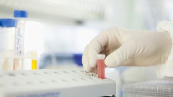 Feds Charge 4 in Massive Medical Billing Scam in NJ