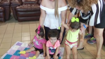 Conjoined Twins Thrive 4 Months After Separation Surgery