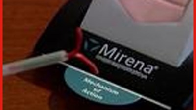 IUDs Help Prevent Cervical Cancer, Study Shows