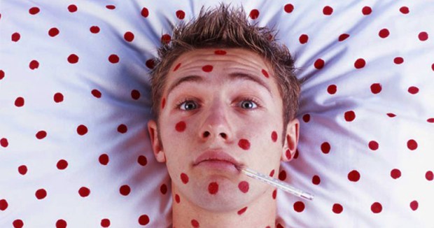 Prosecutor to Parents: Mailing Chickenpox Illegal