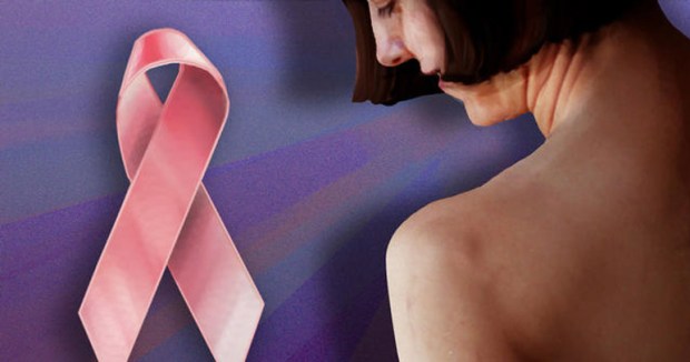 Free Mammograms!