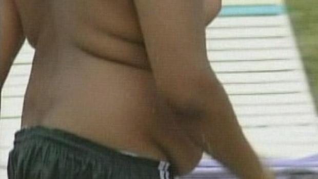Obesity Drops Among NYC Kids K-8