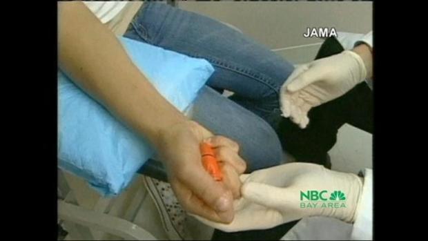 Diabetes Study Shows Benefits of Early Care