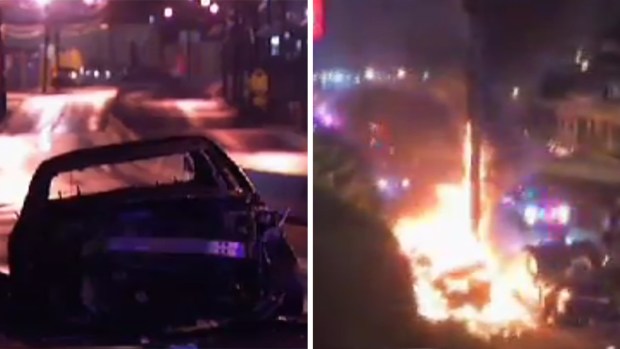 Man kicked by cops in critical with burns