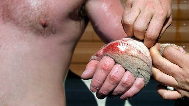 "Knuckle" Trailer a Look at the Madness of Irish Bareknuckle Boxing