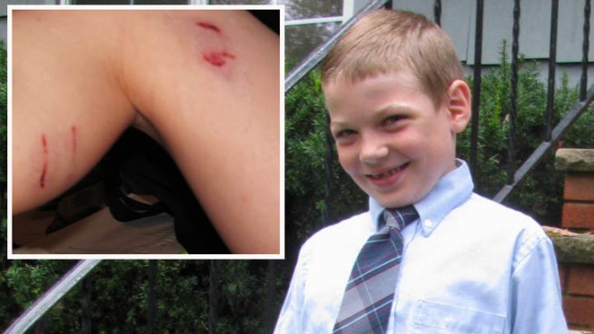 A 7-year-old boy fought off a raccoon that attacked him in his New Jersey backyard just weeks after a dog was bitten by a rabid raccoon in the same town, and authorities are concerned about more sick animals on the loose. Lori Bordonaro reports.