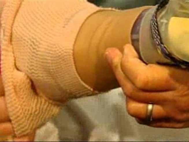 Breakthrough technology gives woman a new lease on life.