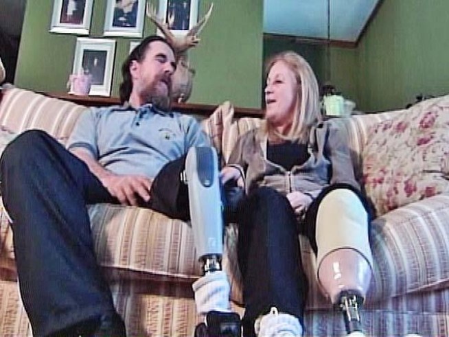 Each lost a leg when their Harley was hit by a distracted driver.