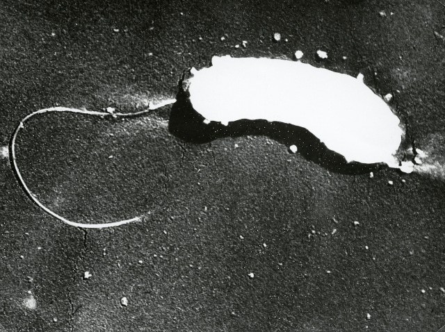 020611 Cholera