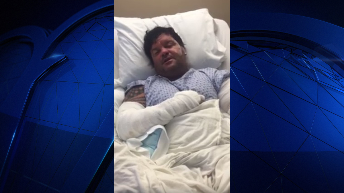 Florida man survives alligator attack while walking dog