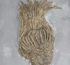 ED_9_bd_meningitis_1200x675_761340995867.jpg