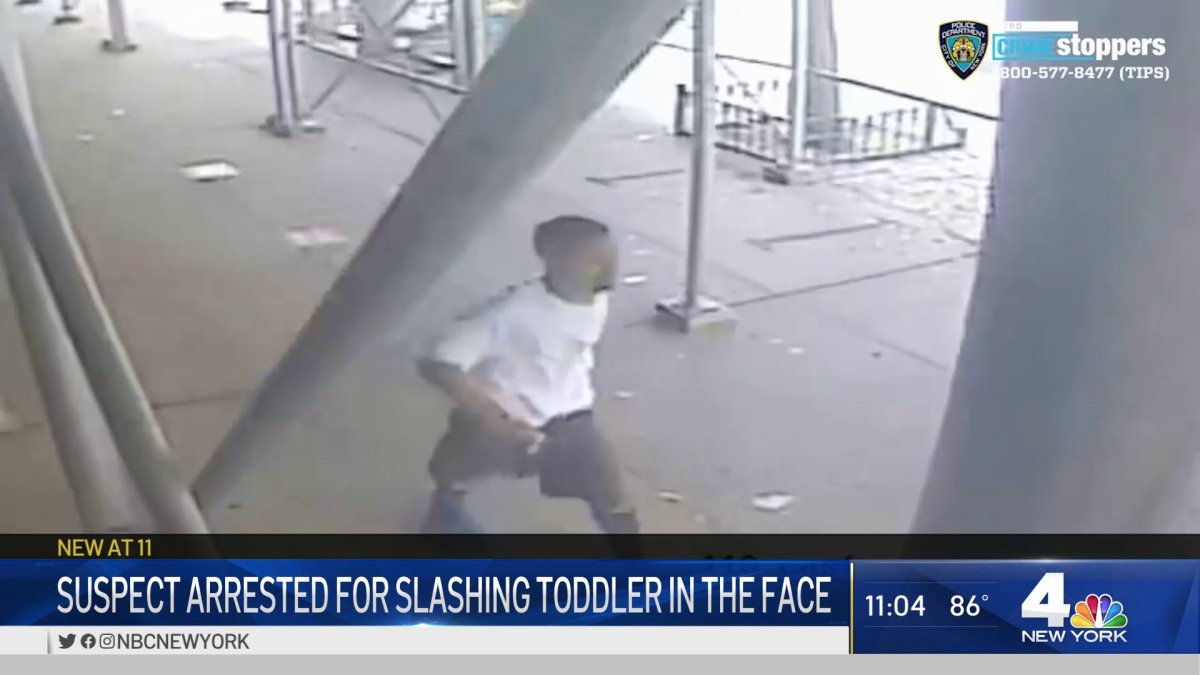 Suspect Arrested for Slashing Toddler in the Face: NYPD – NBC New York