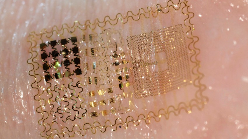 Electronic Skin