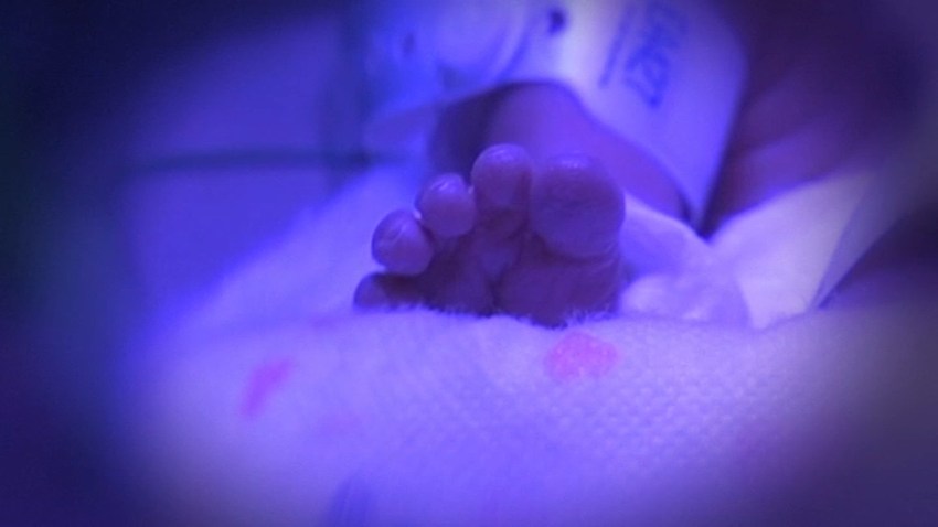 Generic Premature Baby Generic