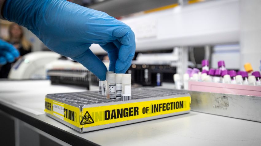 Clinical support technician Douglas Condie extracts viruses from swab samples so that the genetic structure of a virus can be analyzed.