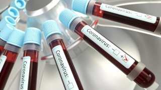 Coronaviruses research, conceptual illustration. Vials of blood in a centrifuge being tested for coronavirus infection.