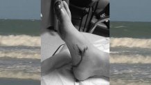 Myrtle Beach Ocean Shark Bite