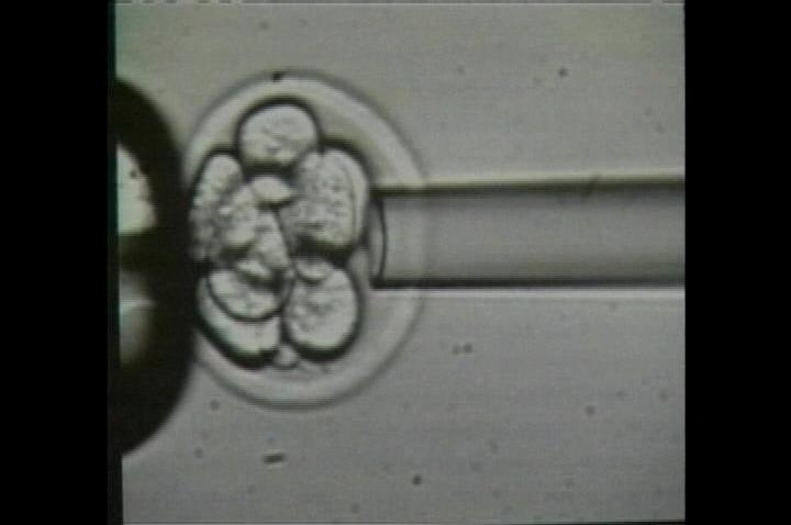 Stem Cell Photo