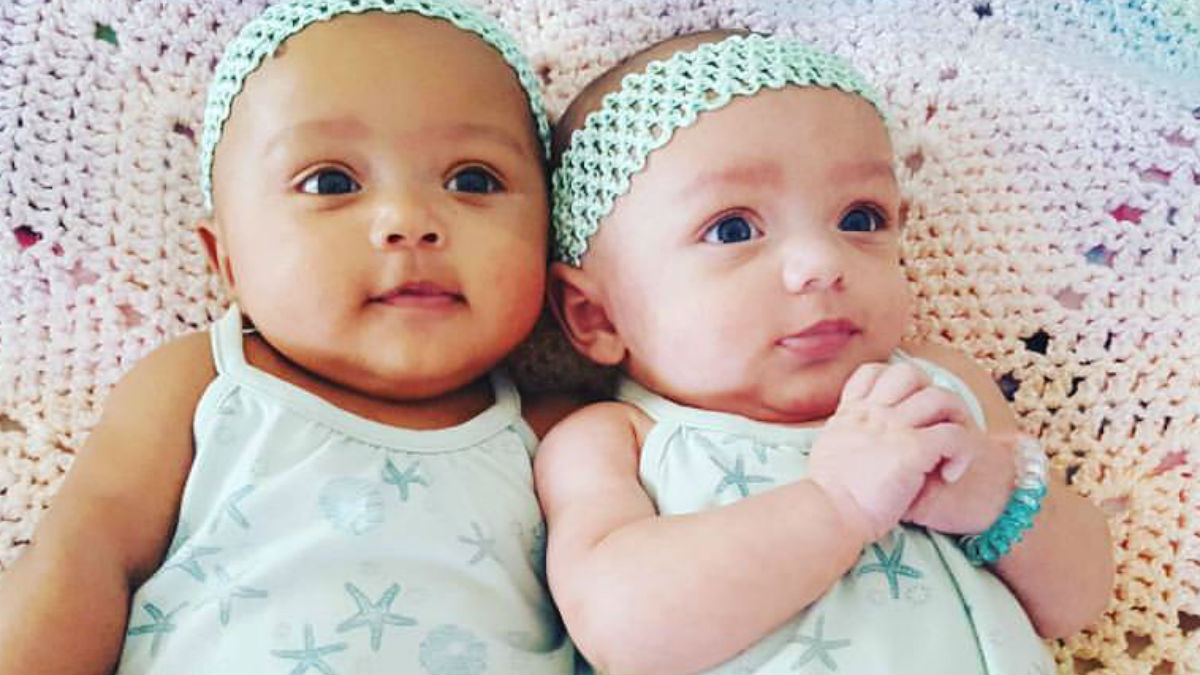 Love Is Love Biracial Twins Born In Illinois With Different Skin Colors Nbc New York