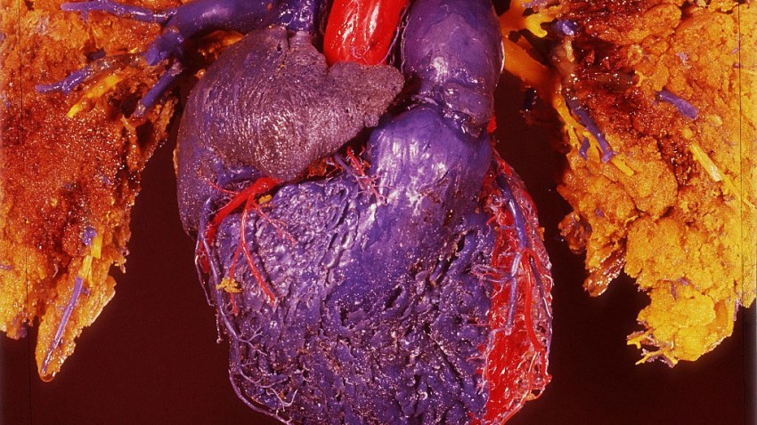 humanheartcopyART_1200x675