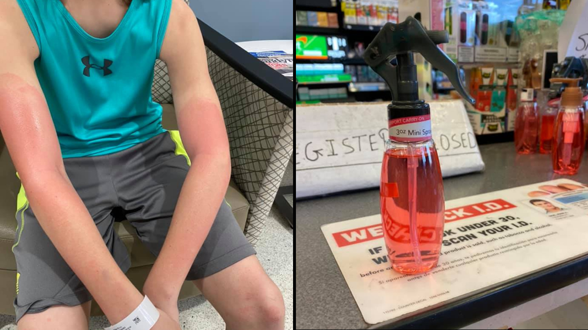 Cops Warn Of ‘Spray Sanitizer’ Sold At NJ 7-Eleven After Mom Reports ...