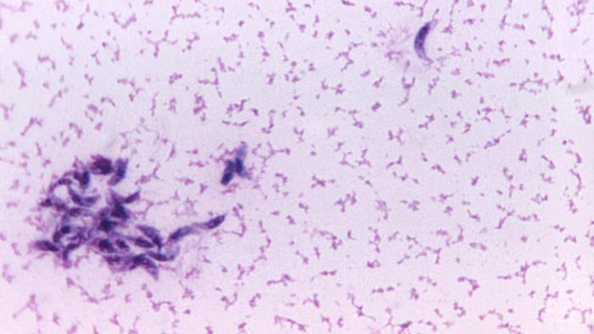 Toxoplasma gondii oocyst picture