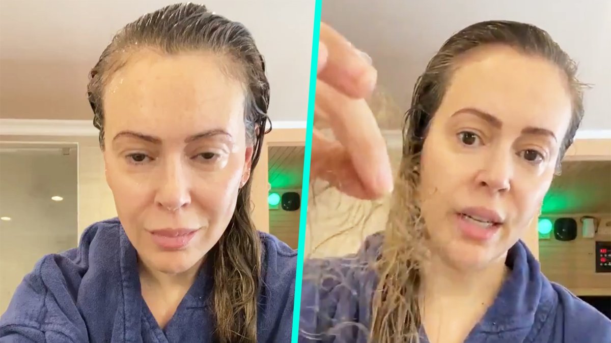 Alyssa Milano Reveals Shocking Hair Loss Months After Battling COVID-19 –  NBC New York