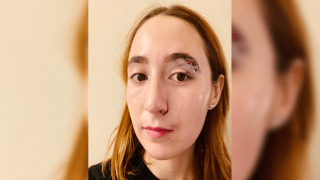 Sam Fox left the hospital Thursday night with 10 stitches after a man sucker-punched her walking down a Manhattan street