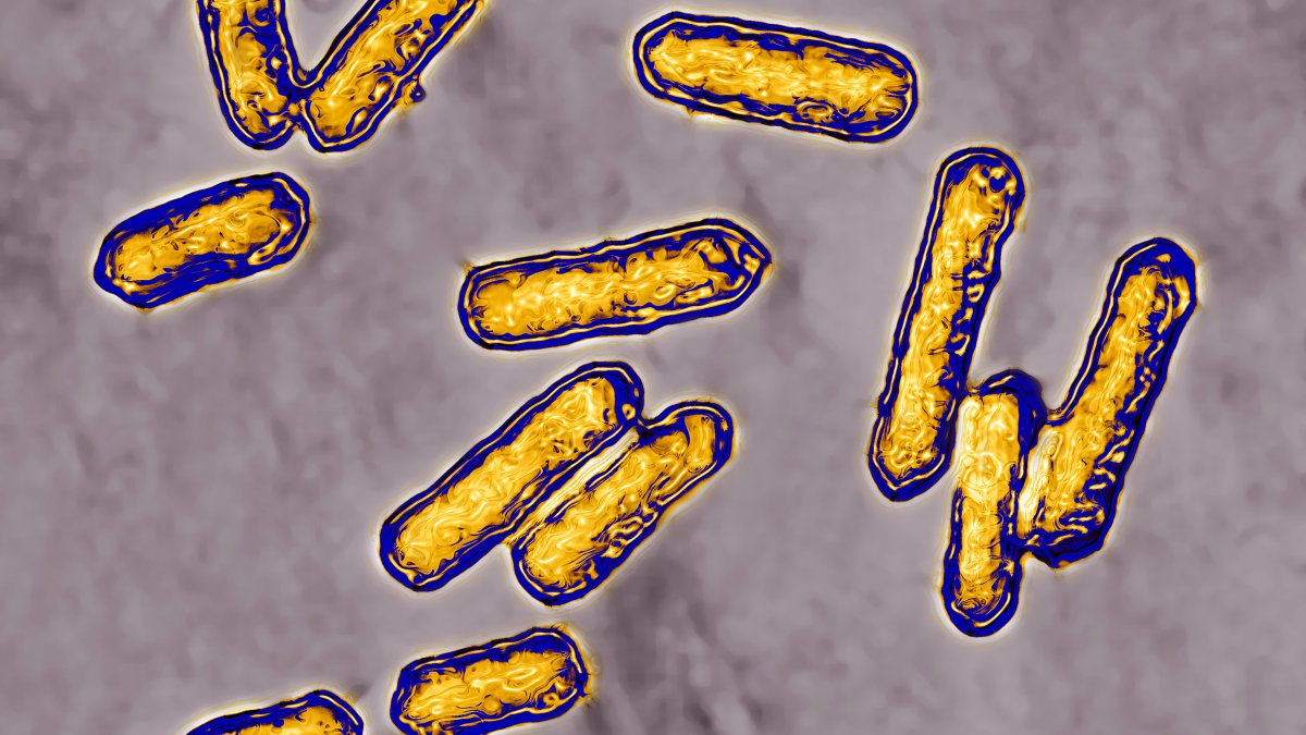 Listeria monocytogenes что это