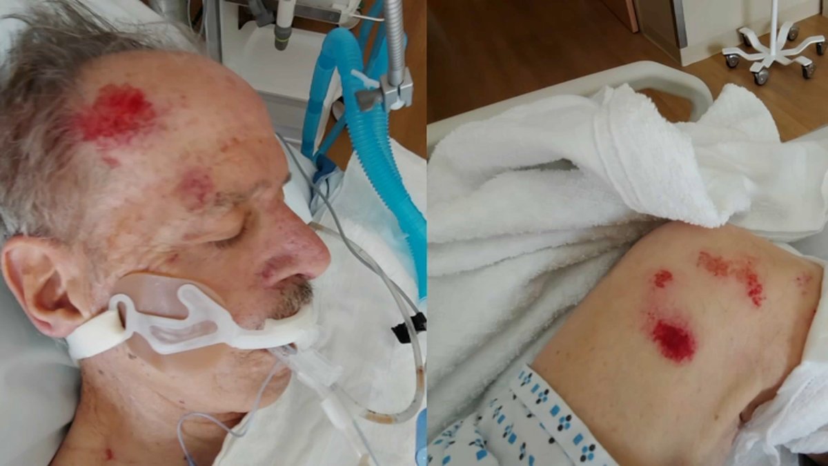 Family Claims Loved One's Brain Injury Was Due to Sheriff's Deputies Excessive Force - Vimarsana News