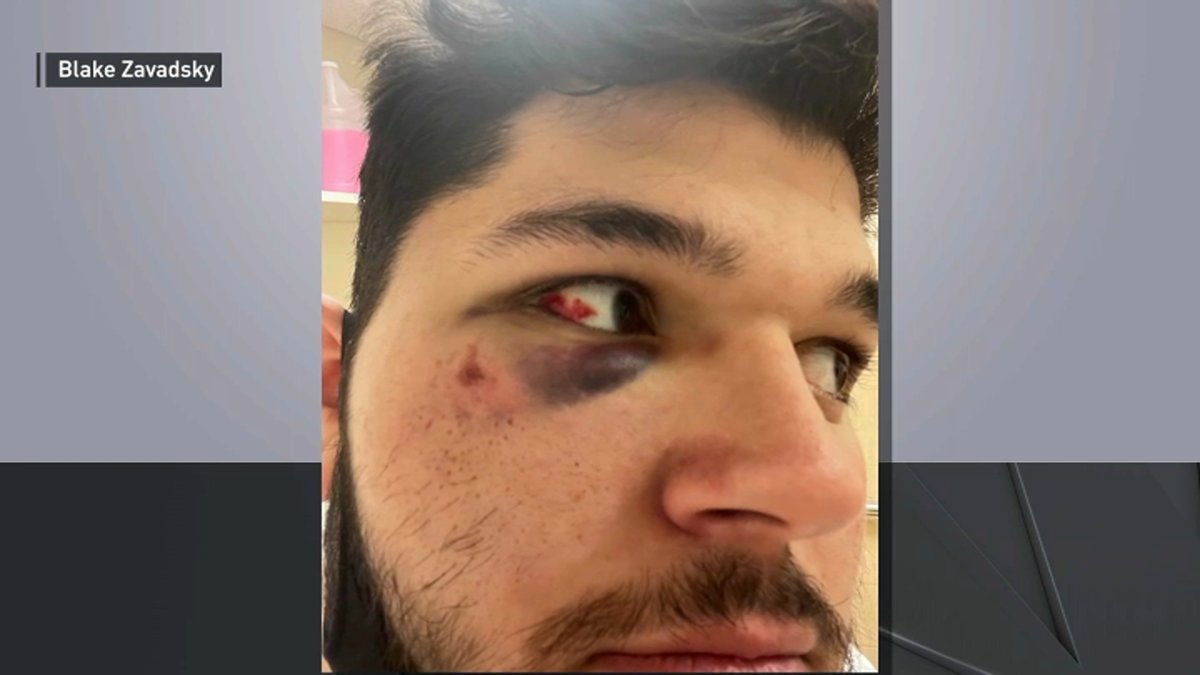 Jewish Man Says He Was Attacked in Brooklyn After Wearing Pro-Israel Clothing: Police - Vimarsana News