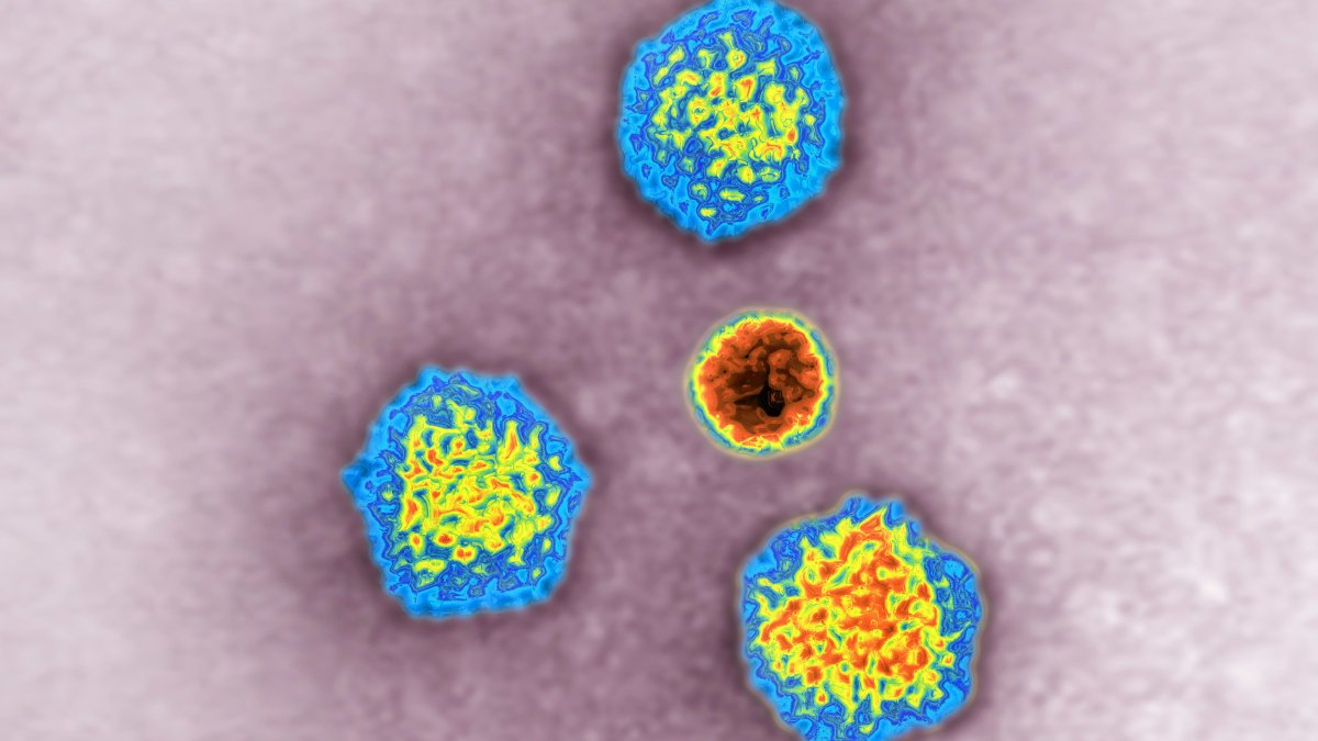 Hepatitis Outbreak 2022 CDC Eyes Adenovirus Link, 109 Cases