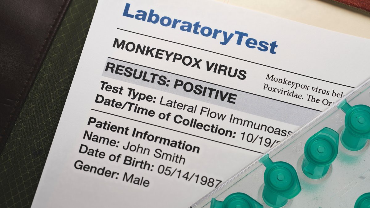 New York monkeypox case boom.Kathy Hochul Promises Vaccine – NBC New York