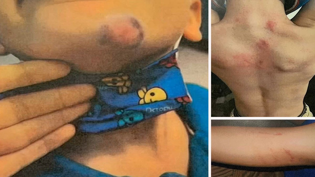 NJ Teacher's Aide Allegedly Beat, 'Dragged' – NBC New York - Vimarsana News