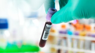 Technician holding a blood sample ready for testing with other human medical samples in the background.