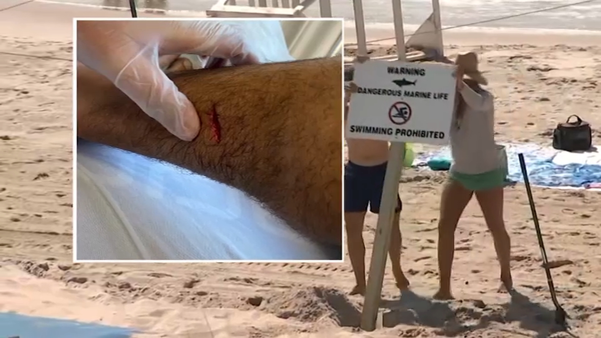 Tybee surf instructor back in the ocean two days after shark bite