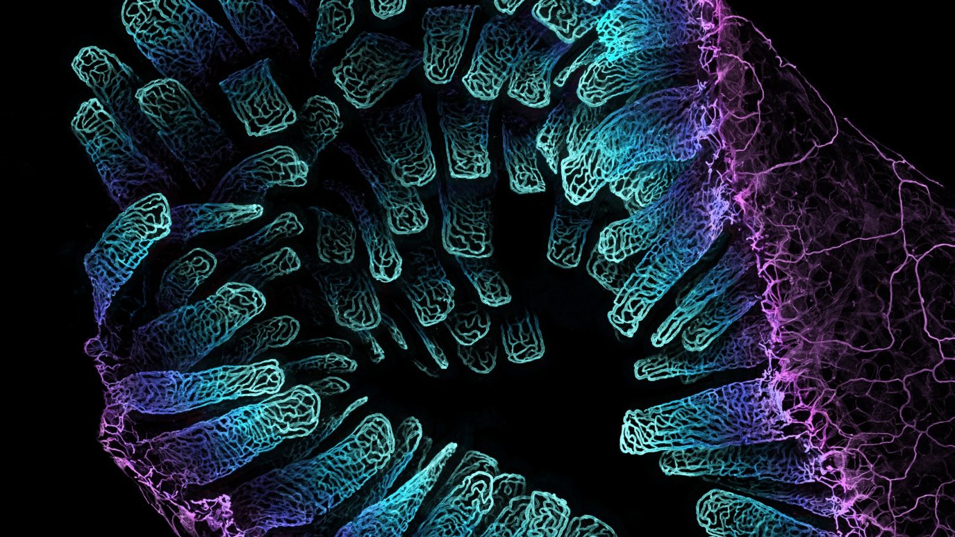 Photos Capture World of Microscopic Wonders NBC New York Photos Capture World of Microscopic Wonders NBC New York