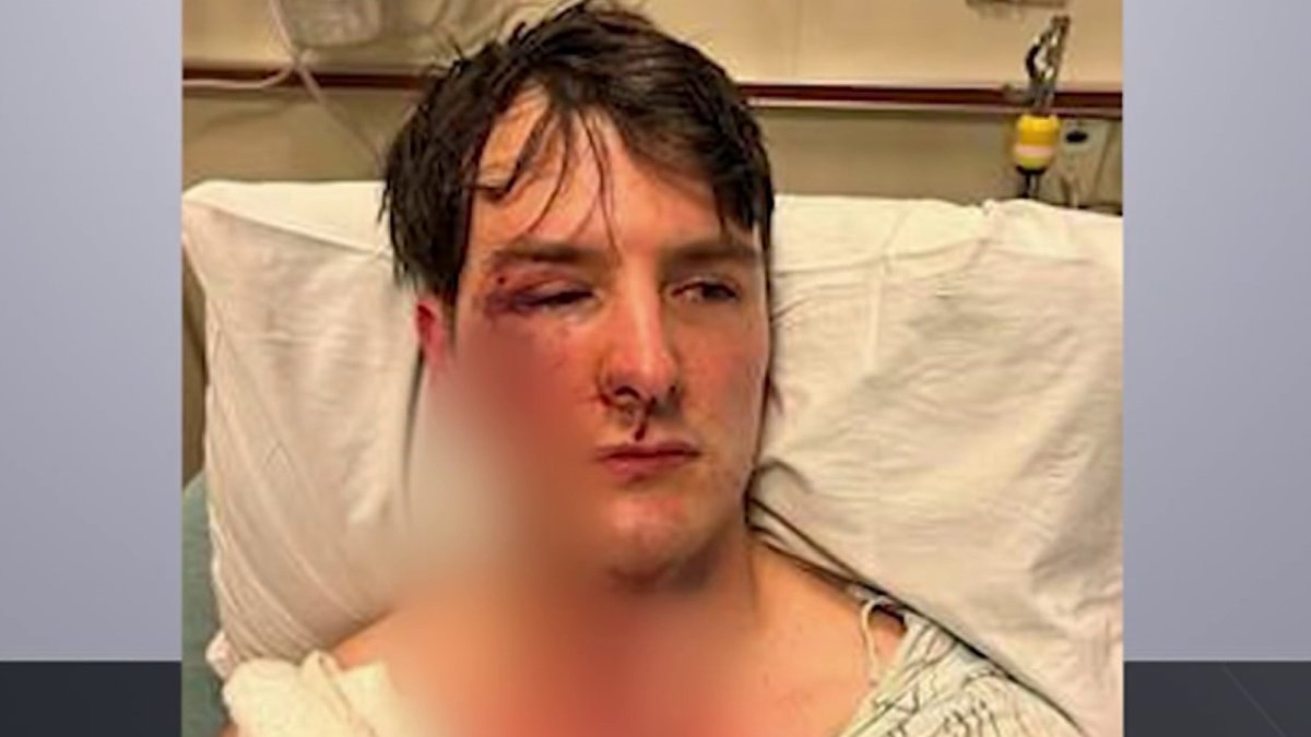Norwalk News: Attorney Calls for Hate Crime for Attack on Owners of Gay Bar Troupe429 – NBC New York - Vimarsana News