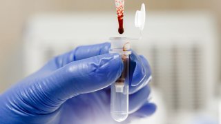 Blood grown in a laboratory has been transfused into humans for the first time in a landmark clinical trial.