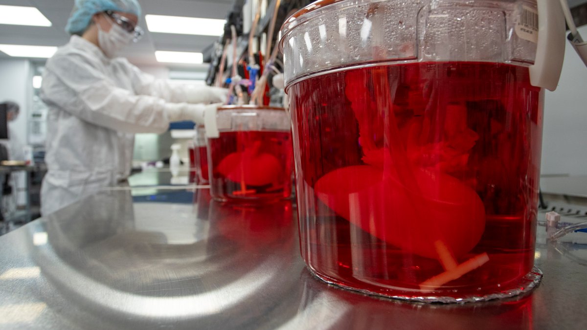 Scientists Seek to Use Pig Livers to Ease Organ Shortage – NBC New York - Vimarsana News