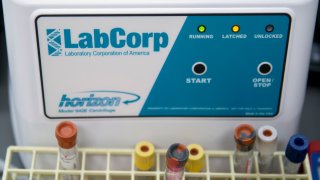 A Laboratory Corporation of America Holdings (LabCorp) 642E centrifuge sits in a Community Clinic Inc. health center in Silver Spring, Maryland.