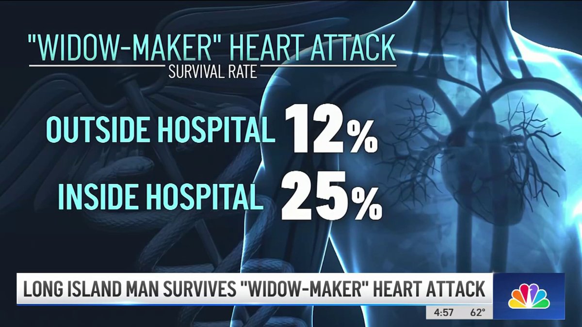 Long Island Man Survives Widow Maker Heart Attack Nbc New York Long Island Man Survives Widow Maker Heart Attack Nbc New York