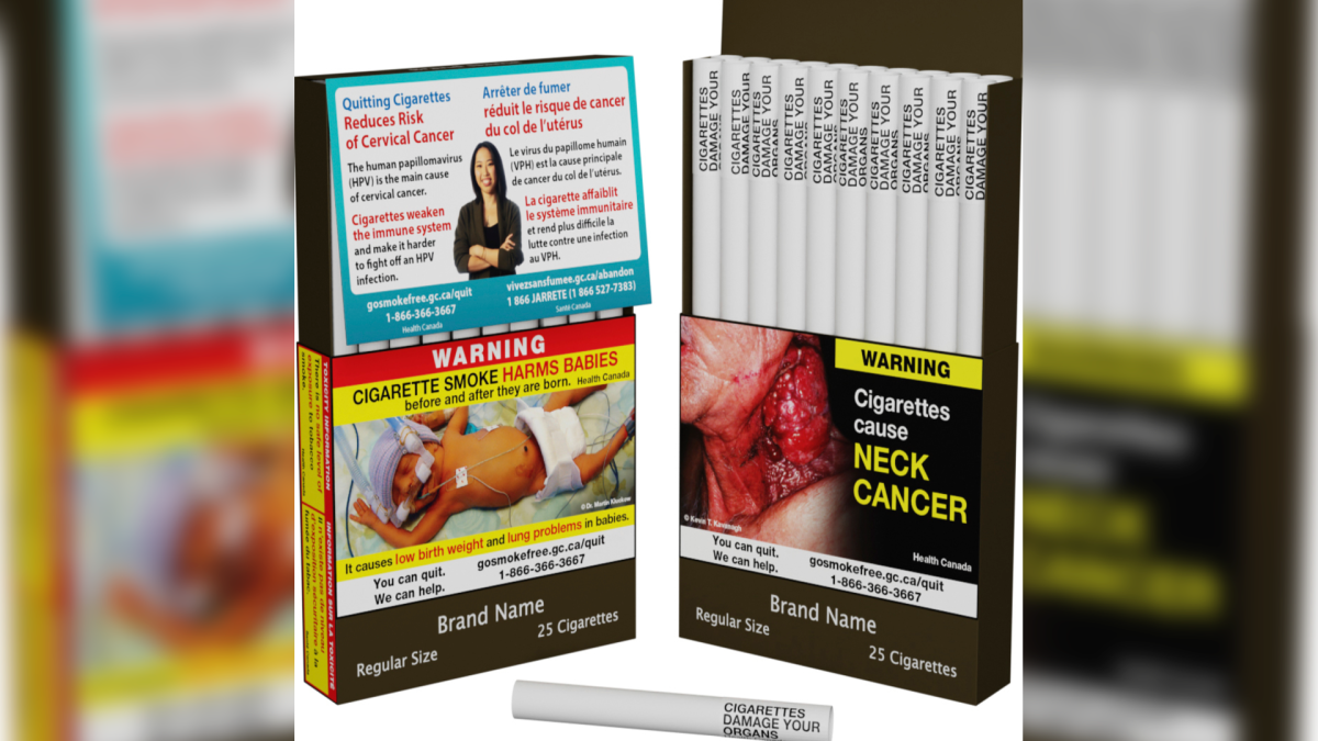 Canada Unveils World's First Individual Cigarette Warning Labels – NBC New York - Vimarsana News