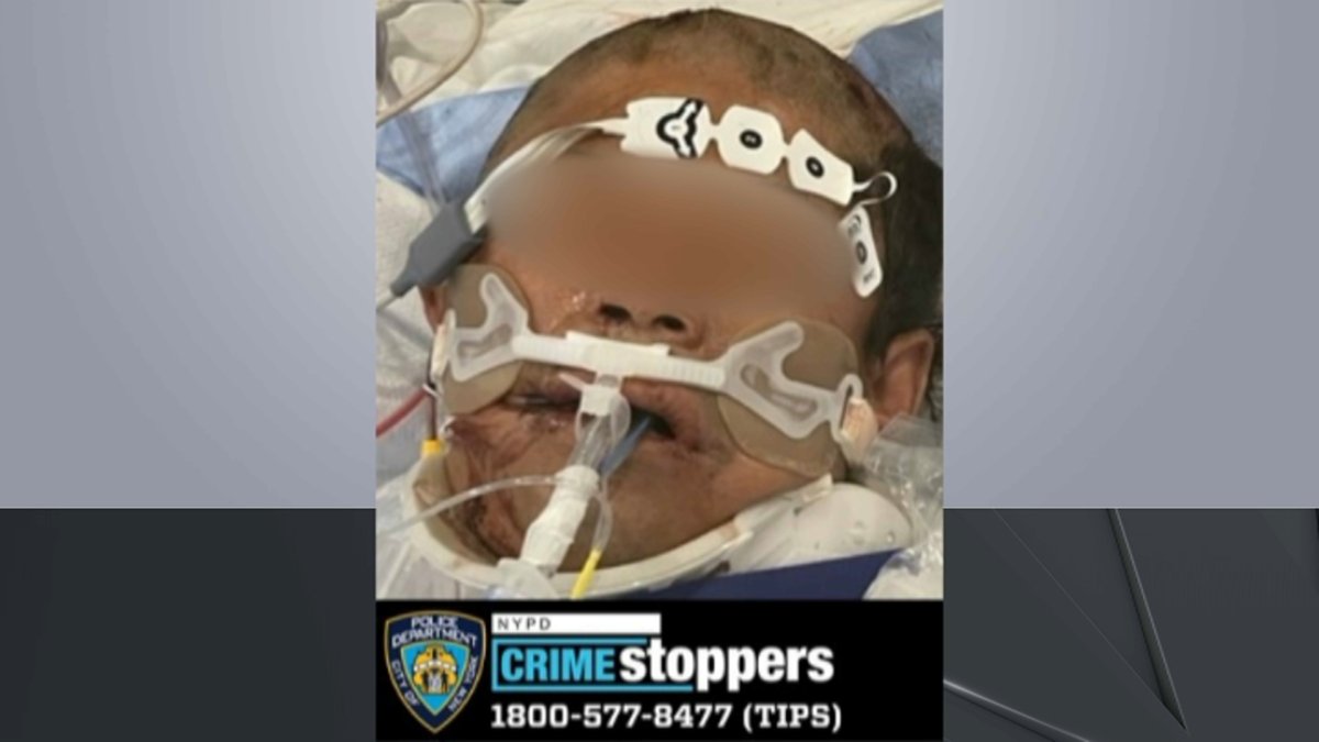 NYC: Unidentified Cyclist in Critical Condition Following Crash, NYPD Says – NBC New York - Vimarsana News