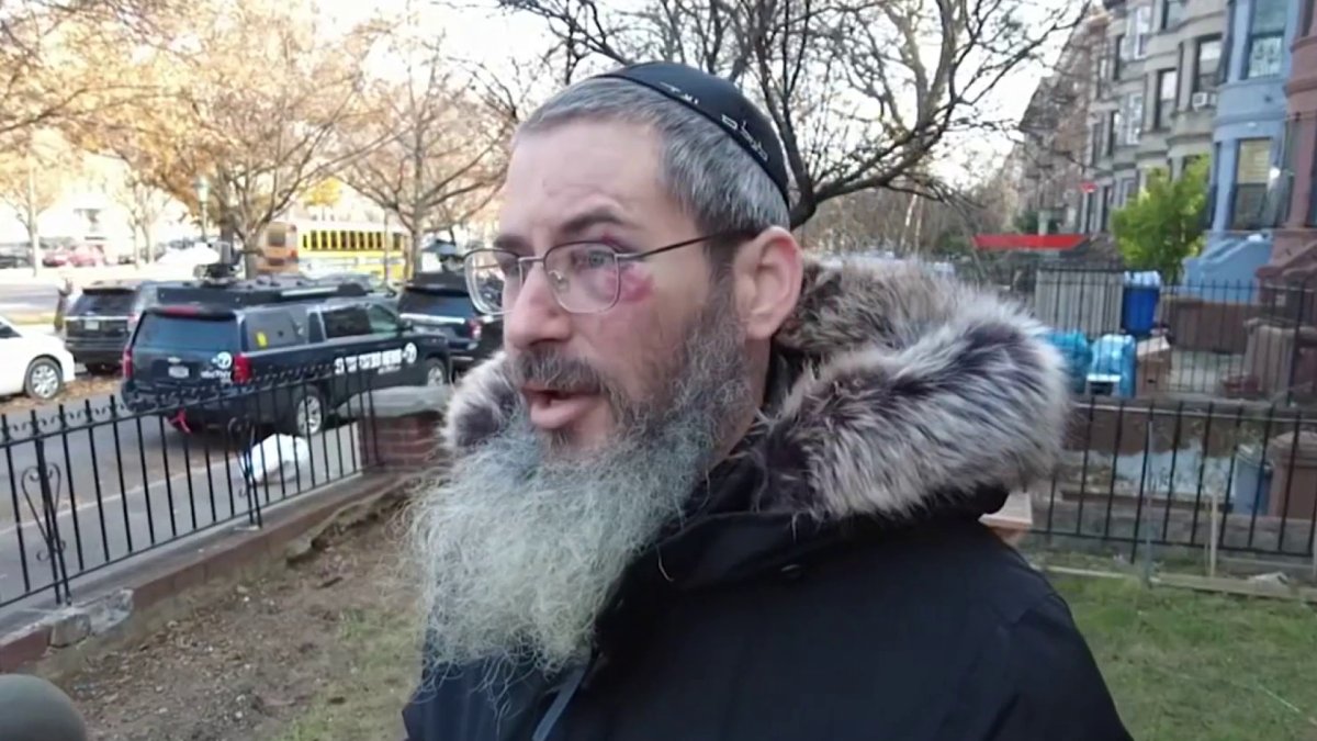Jewish man punched and robbed in Brooklyn as attacker spewed antisemitic profanities NBC New York