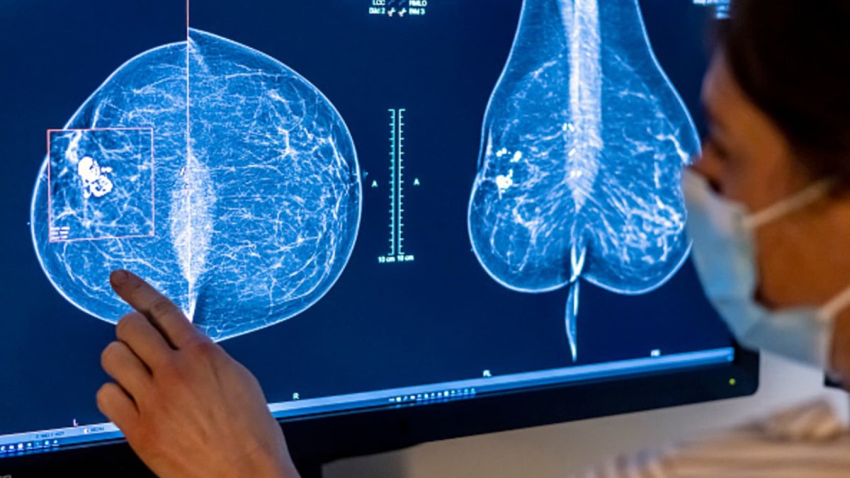 Biotech and pharma companies are betting on a promising class of cancer drugs to drive growth - Vimarsana News