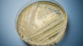 Picture of the yeast candida auris in a petri dish.