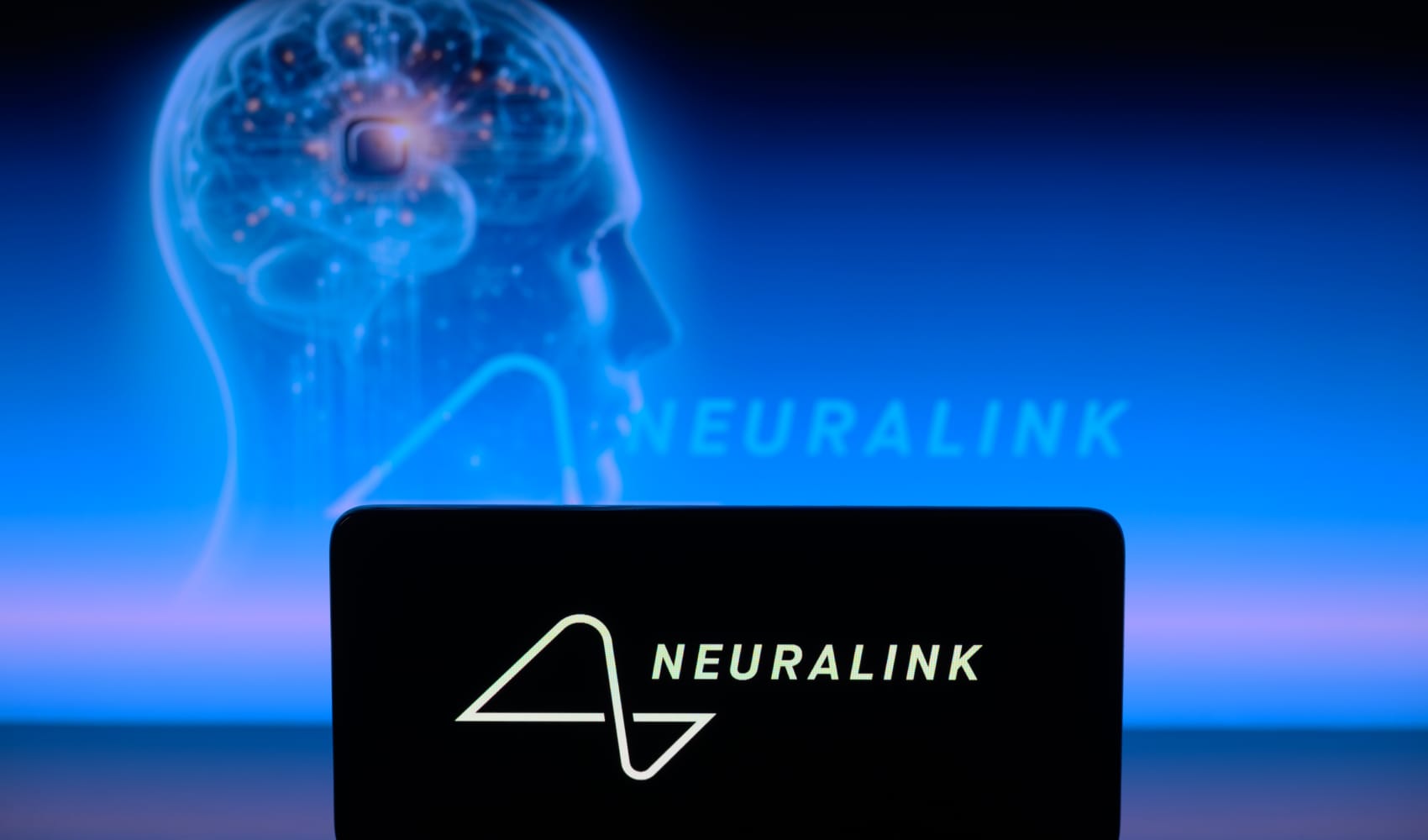 Neuralink shares video of patient playing chess using signals from
brain implant